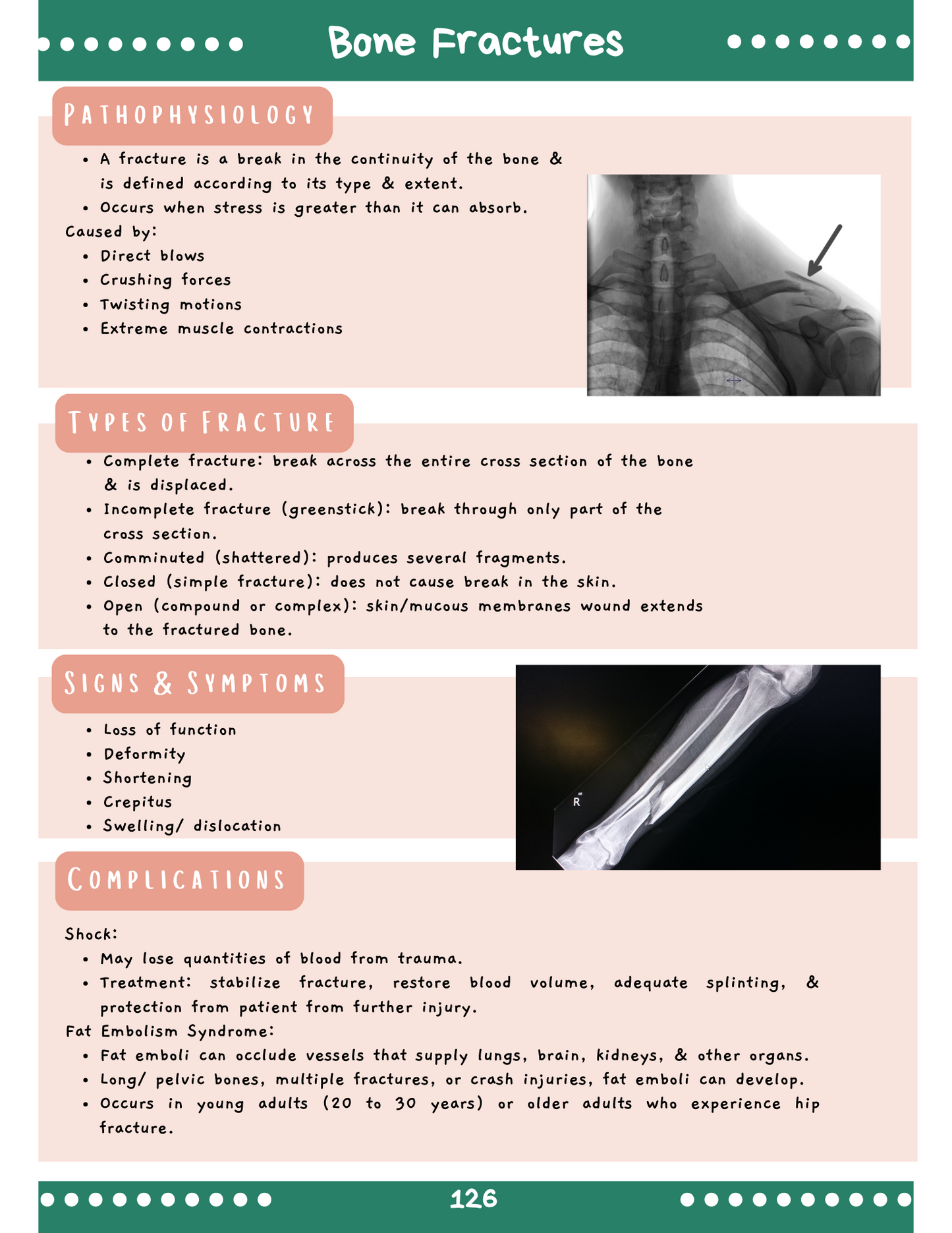 Musculoskeletal System: Med-Surg Study Blueprint Digital Download